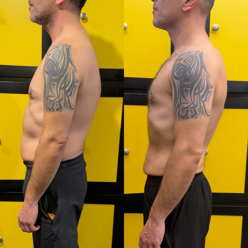 Client before and after, side profile visibly leaner