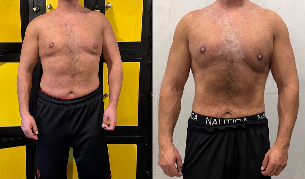 Client before and after, broader chest and shoulders over a leaner waist